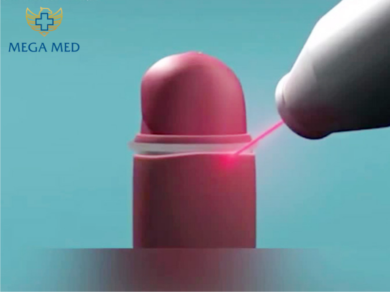 Phương pháp cắt laser